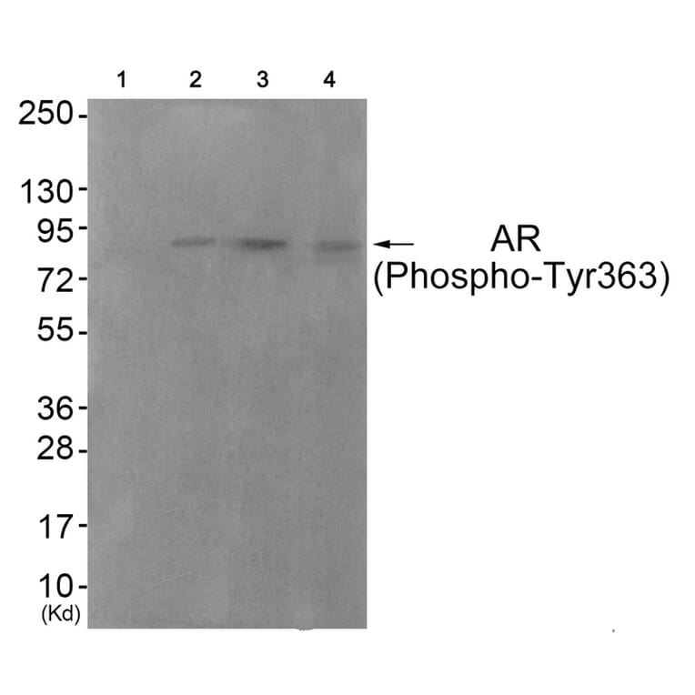 Western blot - Androgen Receptor (Phospho-Tyr363) Antibody from Signalway Antibody (11761) - Antibodies.com