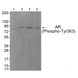Western blot - Androgen Receptor (Phospho-Tyr363) Antibody from Signalway Antibody (11761) - Antibodies.com