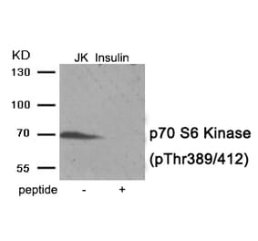 Western blot - p70 S6 Kinase (Phospho-Thr389/412) Antibody from Signalway Antibody (11974) - Antibodies.com