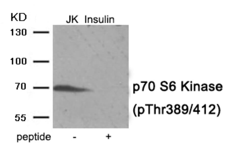 Western blot - p70 S6 Kinase (Phospho-Thr389/412) Antibody from Signalway Antibody (11974) - Antibodies.com