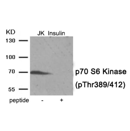 Western blot - p70 S6 Kinase (Phospho-Thr389/412) Antibody from Signalway Antibody (11974) - Antibodies.com