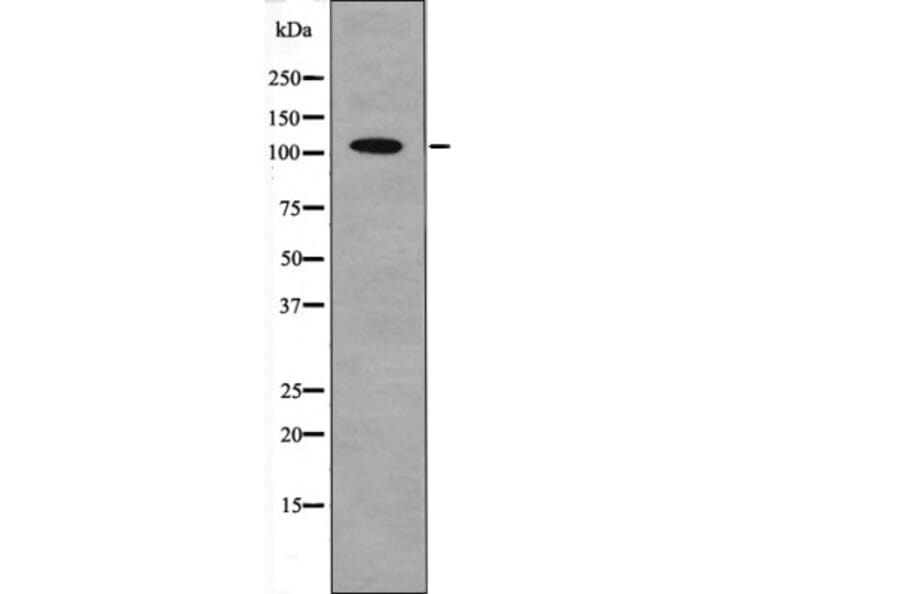 Western blot - Androgen Receptor (Phospho-Tyr267) Antibody from Signalway Antibody (12557) - Antibodies.com