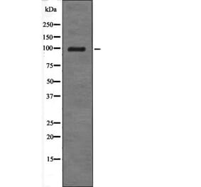 Western blot - Androgen Receptor (Phospho-Tyr534) Antibody from Signalway Antibody (12567) - Antibodies.com