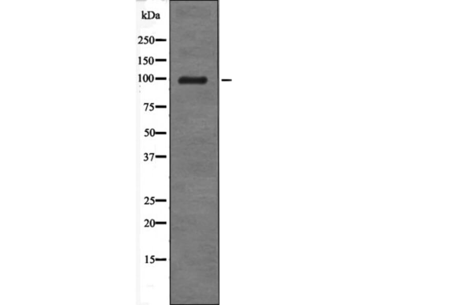 Western blot - Androgen Receptor (Phospho-Tyr534) Antibody from Signalway Antibody (12567) - Antibodies.com