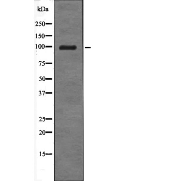 Western blot - Androgen Receptor (Phospho-Tyr534) Antibody from Signalway Antibody (12567) - Antibodies.com