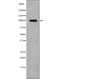 Western blot - Androgen Receptor (Phospho-Ser308) Antibody from Signalway Antibody (12700) - Antibodies.com