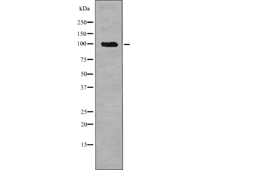 Western blot - Androgen Receptor (Phospho-Ser308) Antibody from Signalway Antibody (12700) - Antibodies.com