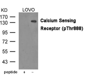 Western blot - Calcium Sensing Receptor (Phospho-Thr888) Antibody from Signalway Antibody (12041) - Antibodies.com