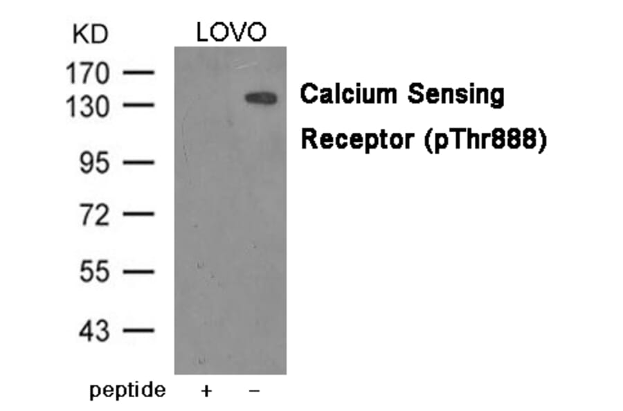 Western blot - Calcium Sensing Receptor (Phospho-Thr888) Antibody from Signalway Antibody (12041) - Antibodies.com