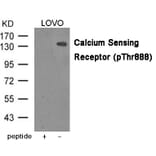 Western blot - Calcium Sensing Receptor (Phospho-Thr888) Antibody from Signalway Antibody (12041) - Antibodies.com