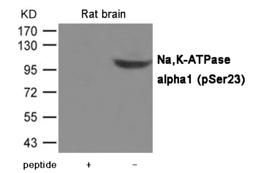 Western blot - Na,K-ATPase alpha1 (Phospho-Ser23) Antibody from Signalway Antibody (12052) - Antibodies.com