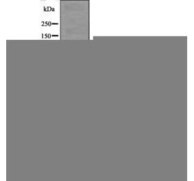 Western blot - Androgen Receptor (Phospho-Ser81) Antibody from Signalway Antibody (12540) - Antibodies.com