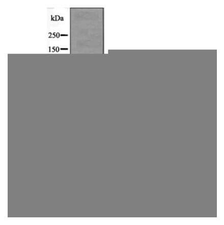 Western blot - Androgen Receptor (Phospho-Ser81) Antibody from Signalway Antibody (12540) - Antibodies.com