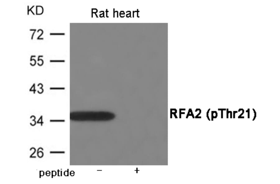 Western blot - RFA2 (Phospho-Thr21) Antibody from Signalway Antibody (12060) - Antibodies.com