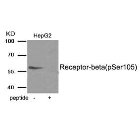 Western blot - Estrogen Receptor- beta (Phospho-Ser105) Antibody from Signalway Antibody (11998) - Antibodies.com