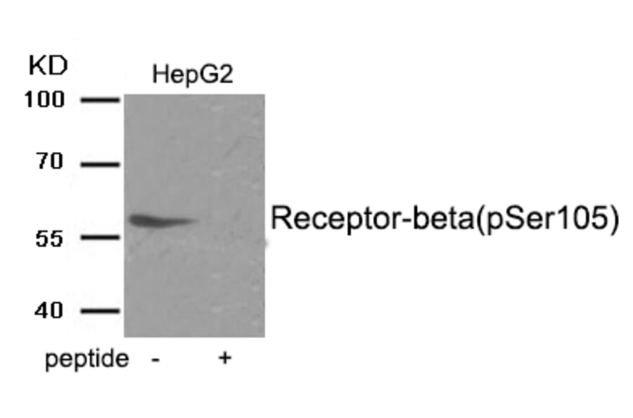 Western blot - Estrogen Receptor- beta (Phospho-Ser105) Antibody from Signalway Antibody (11998) - Antibodies.com