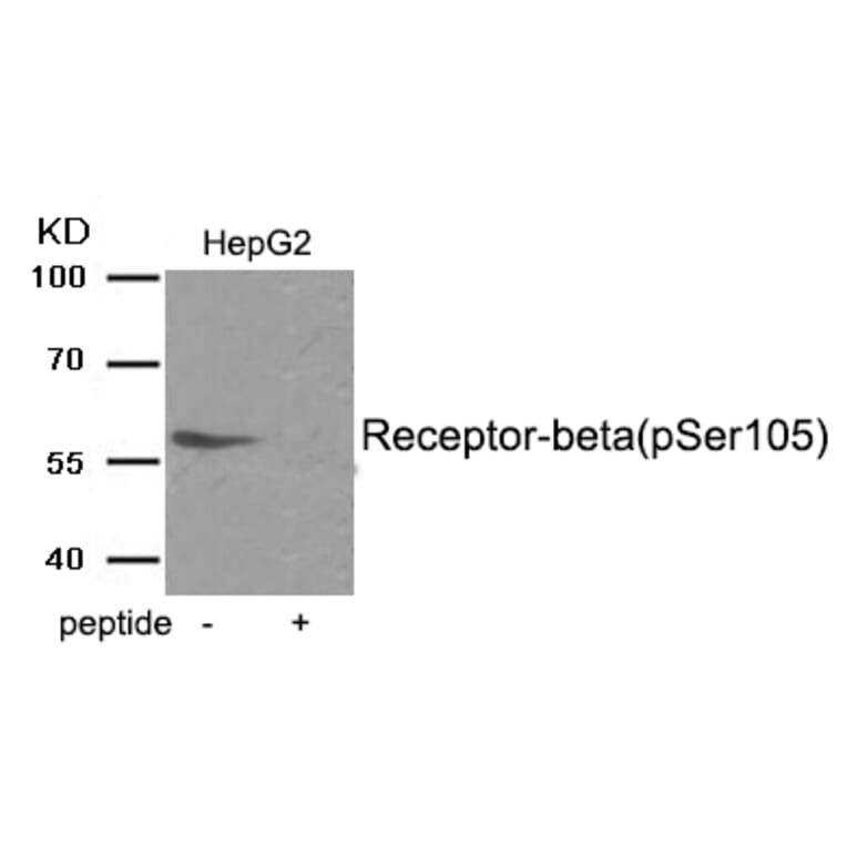 Western blot - Estrogen Receptor- beta (Phospho-Ser105) Antibody from Signalway Antibody (11998) - Antibodies.com