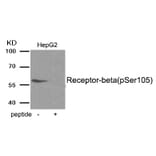 Western blot - Estrogen Receptor- beta (Phospho-Ser105) Antibody from Signalway Antibody (11998) - Antibodies.com