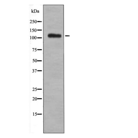 Western blot - EPHB1/2/3/4 (Phospho-Tyr600/602/614/596) Antibody from Signalway Antibody (12501) - Antibodies.com