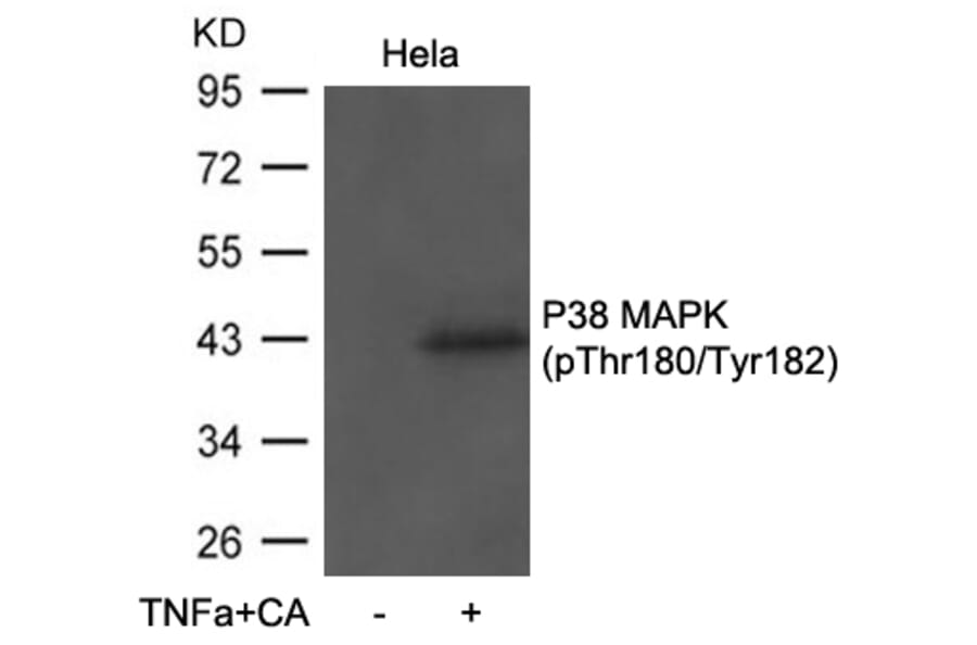 Western blot - P38 MAPK (Phospho-Thr180/Tyr182) antibody from Signalway Antibody (11581) - Antibodies.com