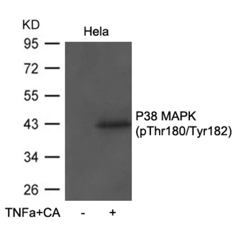 Western blot - P38 MAPK (Phospho-Thr180/Tyr182) antibody from Signalway Antibody (11581) - Antibodies.com