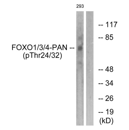 Western blot - FOXO1/3/4-pan (Phospho-Thr24/32) Antibody from Signalway Antibody (11660) - Antibodies.com