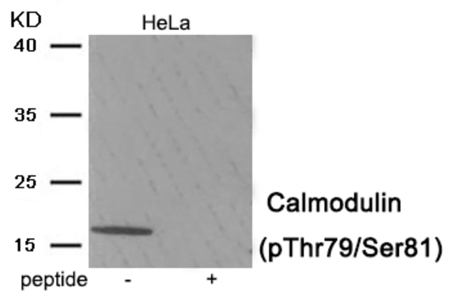 Western blot - Calmodulin (Phospho-Thr79/Ser81) Antibody from Signalway Antibody (11978) - Antibodies.com
