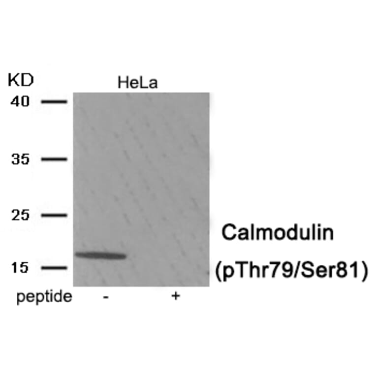 Western blot - Calmodulin (Phospho-Thr79/Ser81) Antibody from Signalway Antibody (11978) - Antibodies.com