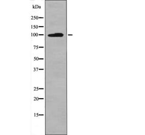 Western blot - Leptin Receptor (Phospho-Tyr986) Antibody from Signalway Antibody (12558) - Antibodies.com