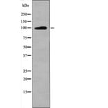 Western blot - Leptin Receptor (Phospho-Tyr986) Antibody from Signalway Antibody (12558) - Antibodies.com