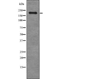 Western blot - LTK/ALK (Phospho-Tyr672/Tyr1278) Antibody from Signalway Antibody (12729) - Antibodies.com