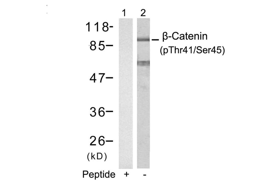 Western blot - b-Catenin (Phospho-Thr41/Ser45) Antibody from Signalway Antibody (11116) - Antibodies.com