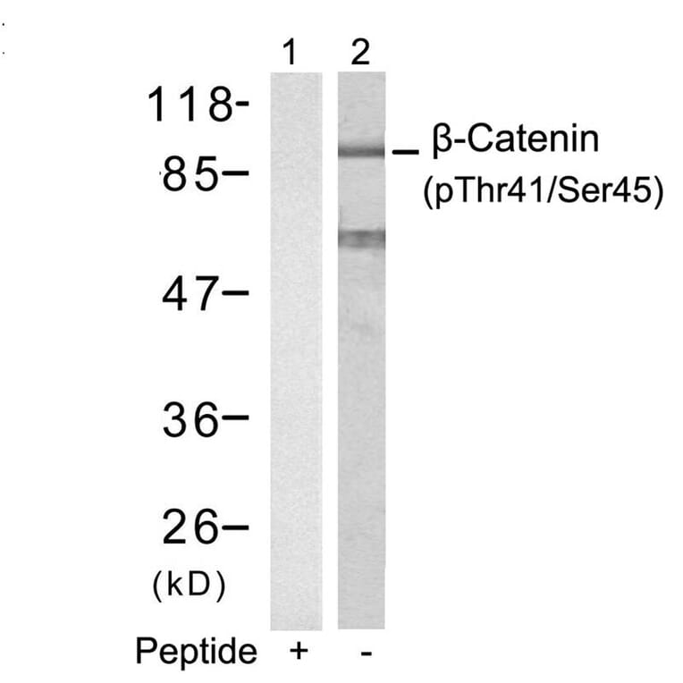 Western blot - b-Catenin (Phospho-Thr41/Ser45) Antibody from Signalway Antibody (11116) - Antibodies.com