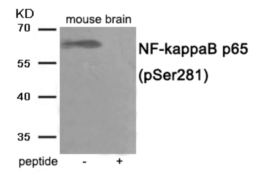 Western blot - NF- kappaB p65 (Phospho-Ser281) Antibody from Signalway Antibody (12000) - Antibodies.com