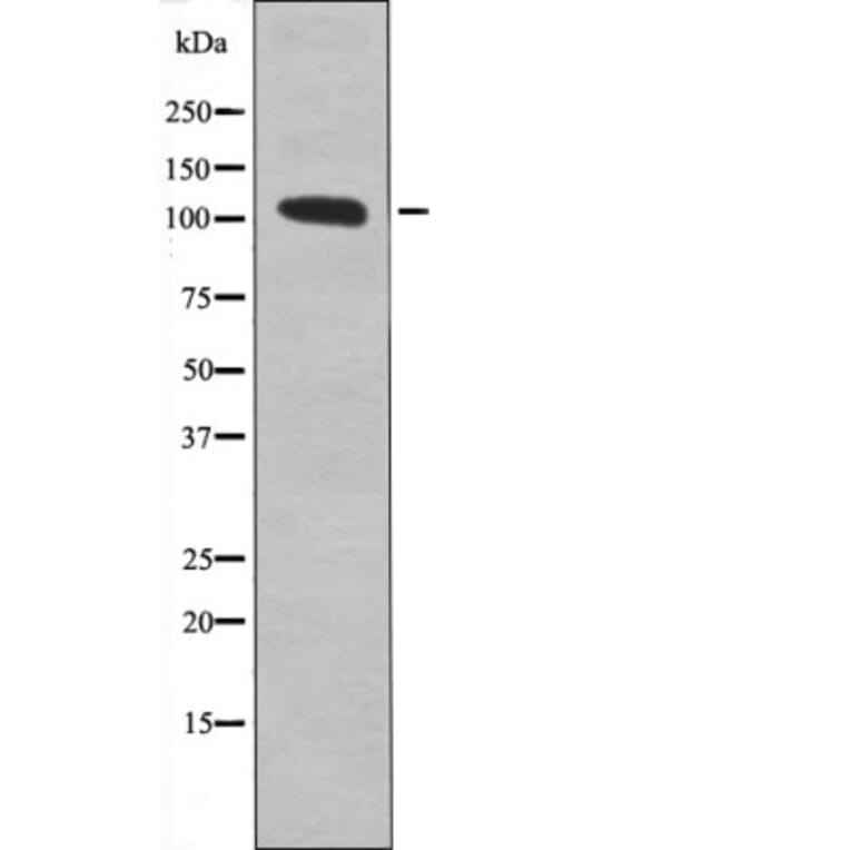 Western blot - Retinoblastoma (Phospho-Ser612) Antibody from Signalway Antibody (12435) - Antibodies.com