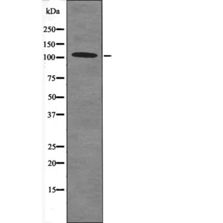 Western blot - Retinoblastoma (Phospho-Thr252) Antibody from Signalway Antibody (12482) - Antibodies.com