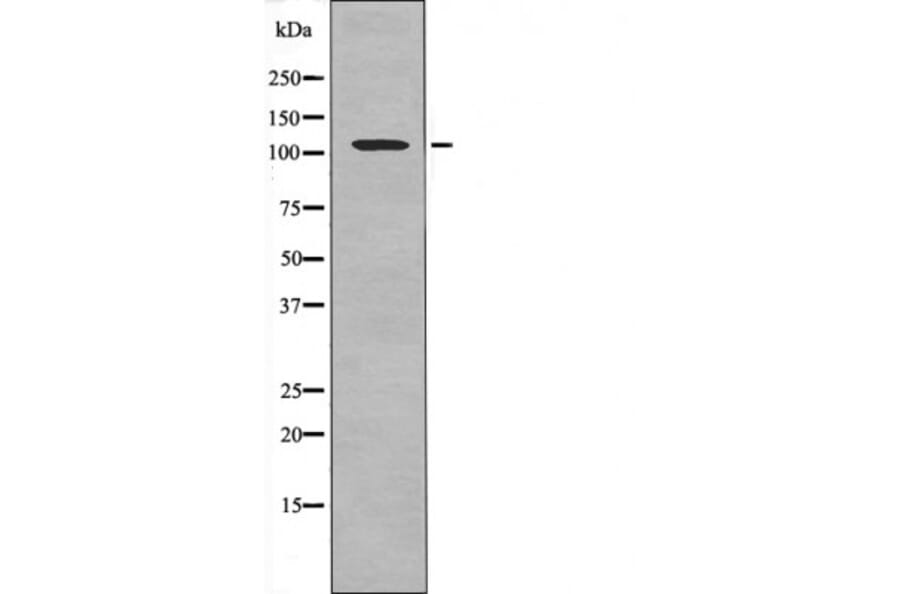 Western blot - Retinoblastoma (Phospho-Ser788) Antibody from Signalway Antibody (12483) - Antibodies.com