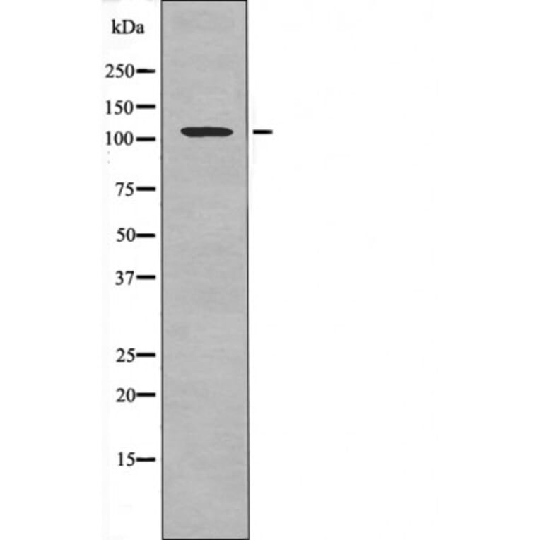 Western blot - Retinoblastoma (Phospho-Ser788) Antibody from Signalway Antibody (12483) - Antibodies.com