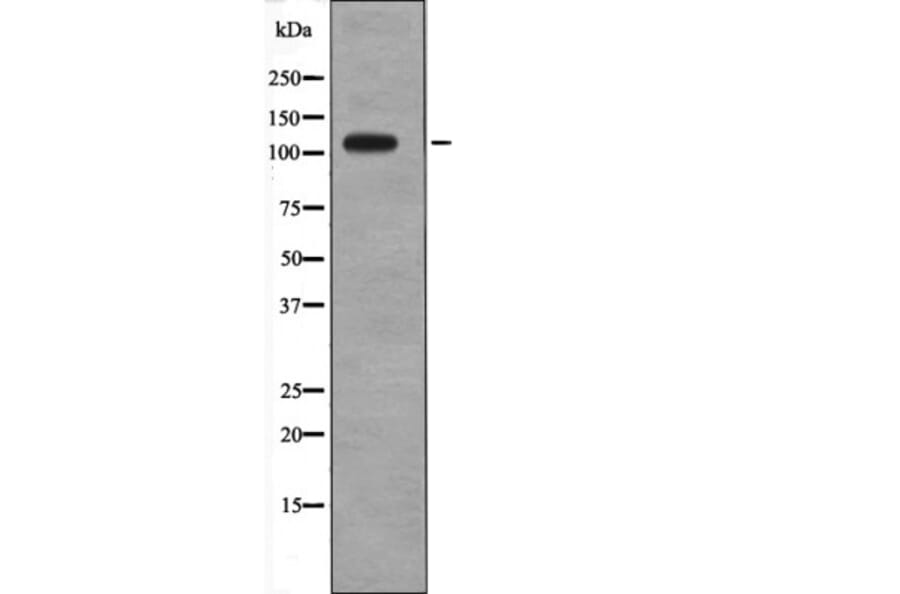 Western blot - Retinoblastoma (Phospho-Thr373) Antibody from Signalway Antibody (12695) - Antibodies.com