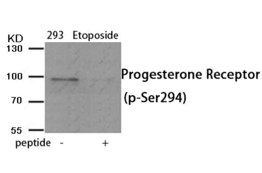 Western blot - Progesterone Receptor (Phospho-Ser294) Antibody from Signalway Antibody (11991) - Antibodies.com