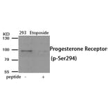 Western blot - Progesterone Receptor (Phospho-Ser294) Antibody from Signalway Antibody (11991) - Antibodies.com