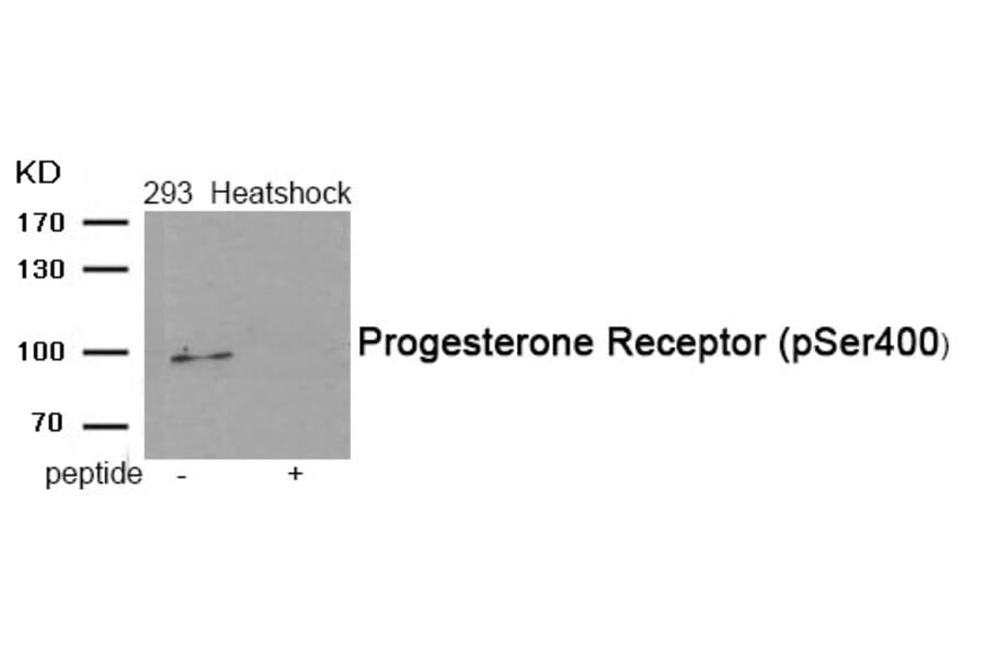 Western blot - Progesterone Receptor (Phospho-Ser400) Antibody from Signalway Antibody (11992) - Antibodies.com