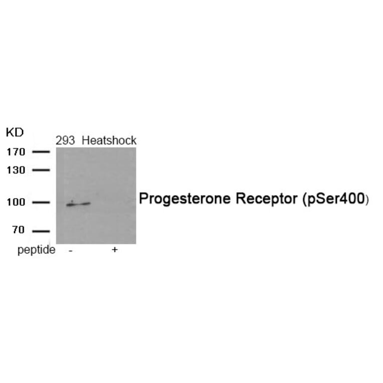 Western blot - Progesterone Receptor (Phospho-Ser400) Antibody from Signalway Antibody (11992) - Antibodies.com