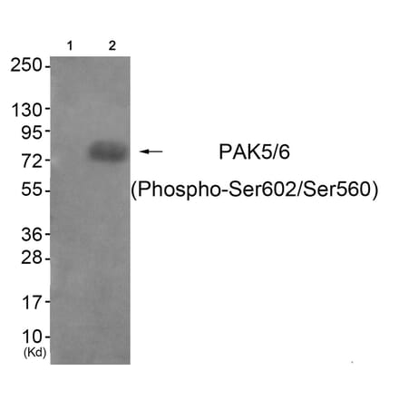 Western blot - PAK5/6 (Phospho-Ser602/Ser560) Antibody from Signalway Antibody (11812) - Antibodies.com