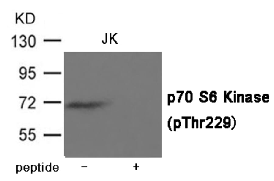 Western blot - p70 S6 Kinase (Phospho-Thr229) Antibody from Signalway Antibody (12021) - Antibodies.com