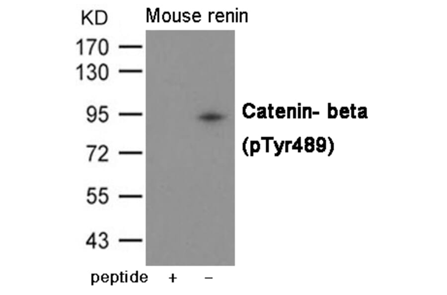 Western blot - Catenin- beta (Phospho-Tyr489) Antibody from Signalway Antibody (12061) - Antibodies.com