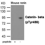 Western blot - Catenin- beta (Phospho-Tyr489) Antibody from Signalway Antibody (12061) - Antibodies.com