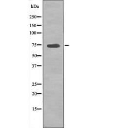 Western blot - p70 S6 Kinase (Phospho-Ser427) Antibody from Signalway Antibody (12524) - Antibodies.com