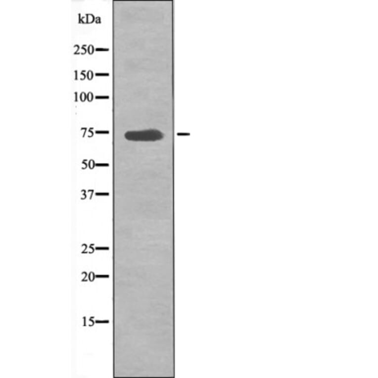 Western blot - p70 S6 Kinase (Phospho-Ser427) Antibody from Signalway Antibody (12524) - Antibodies.com