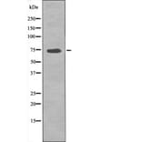 Western blot - p70 S6 Kinase (Phospho-Ser427) Antibody from Signalway Antibody (12524) - Antibodies.com